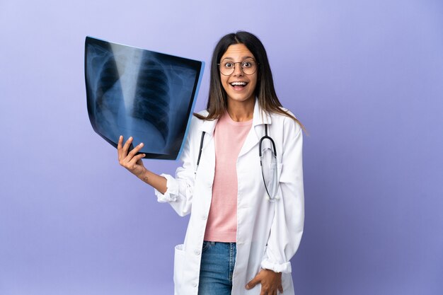 Jeune femme médecin tenant une radiographie avec une expression faciale surprise