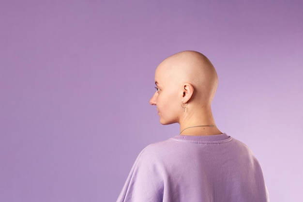 Jeune femme souffrant d'un cancer rire sourire se sentir positif quant à la future reprise Femme millénaire avec la tête rasée