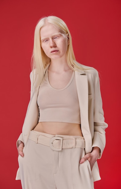 Jeune fille albinos en costume élégant