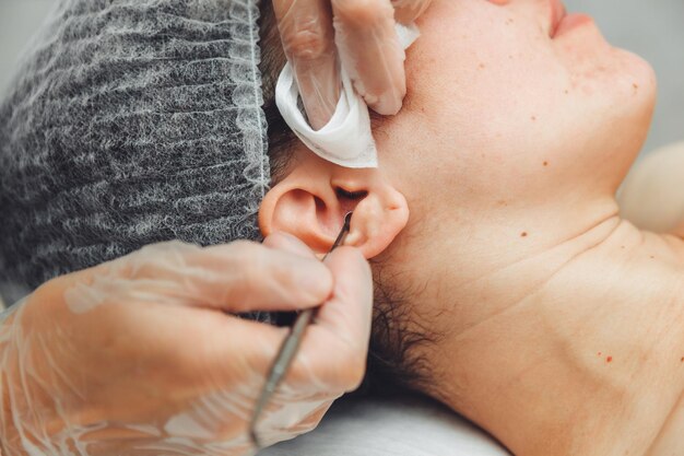 Photo une jeune fille est allongée sur un canapé pendant des procédures cosmétiques sur lesquelles un cosmétologue élimine les dépôts de graisse et les boutons avec un nettoyage spécial des oreilles en métal