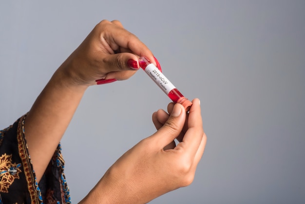 Jeune fille tenant un tube à essai avec un échantillon de sang pour le coronavirus ou l'analyse 2019-nCoV.