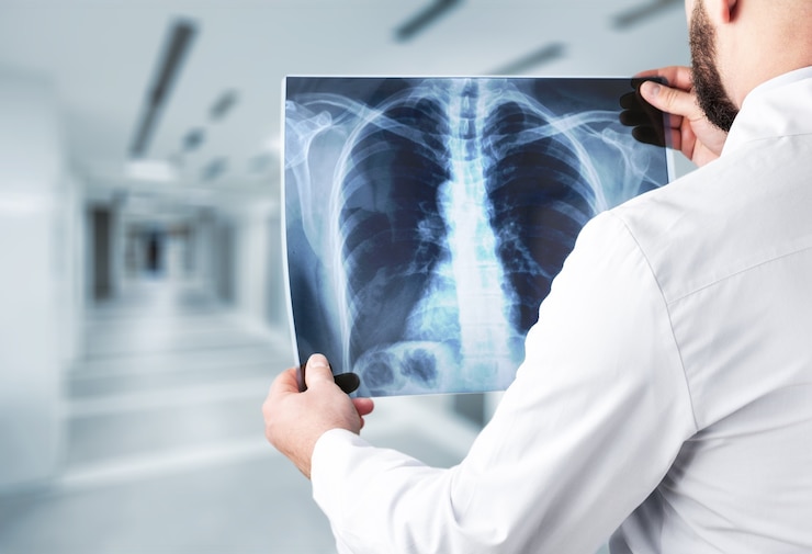 Photo jeune homme médecin tenant une radiographie