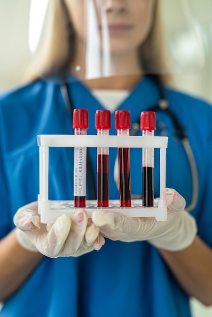 Une jeune infirmière en uniforme transporte des tubes à essai avec des échantillons de sang au laboratoire Concept de médecine
