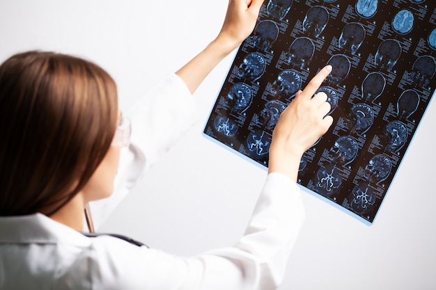 Photo jeune médecin examine une image irm d'un patient