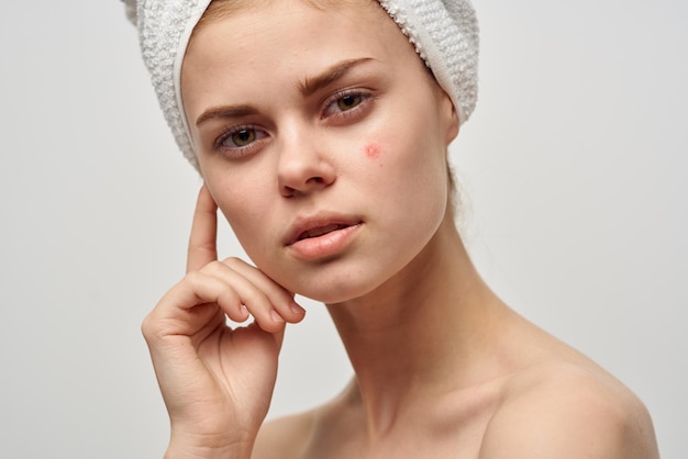 jolie femme avec un bouton sur le visage dermatologie arrière-plan isolé photo de haute qualité