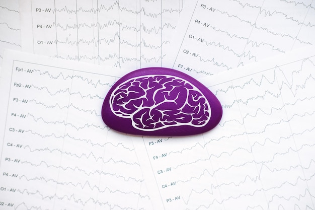 Journée internationale de l'épilepsie sensibilisation à l'épilepsie cerveau violet s'appuyant sur les ondes cérébrales sur