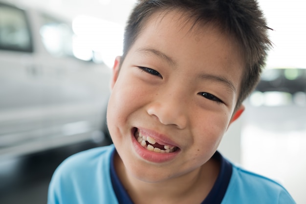 Kid dent cassée, garçon asiatique souriant