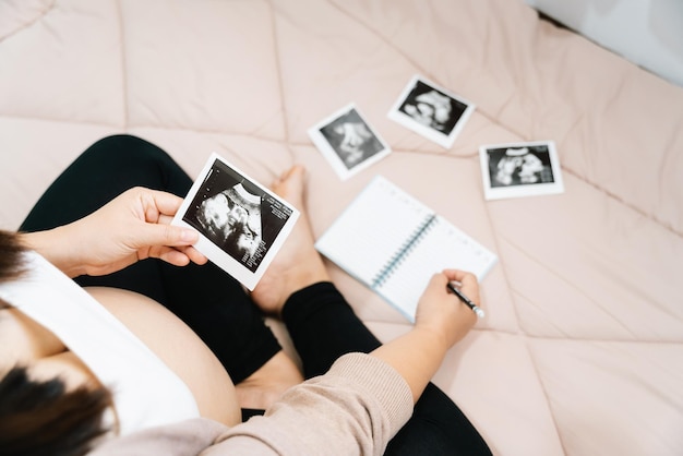 Une laiterie de grossesseVue de dessus d'une femme enceinte écrivant ses pensées dans un cahier pour la mémoireImage radiographique de son bébé et de ses chaussuresConcept de grossesse Soins prénataux de maternité