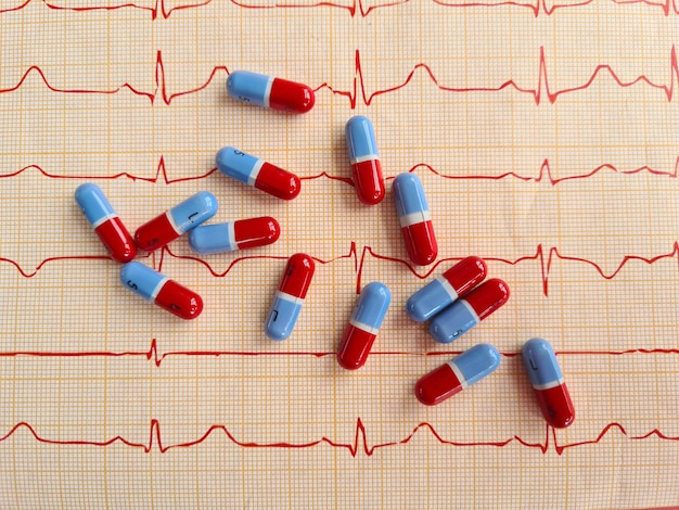 Électrocardiogramme avec gros plan de pilules bleues rouges Examen médical du cœur