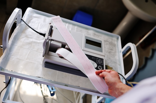 Électrocardiogramme en infirmière mains closeup