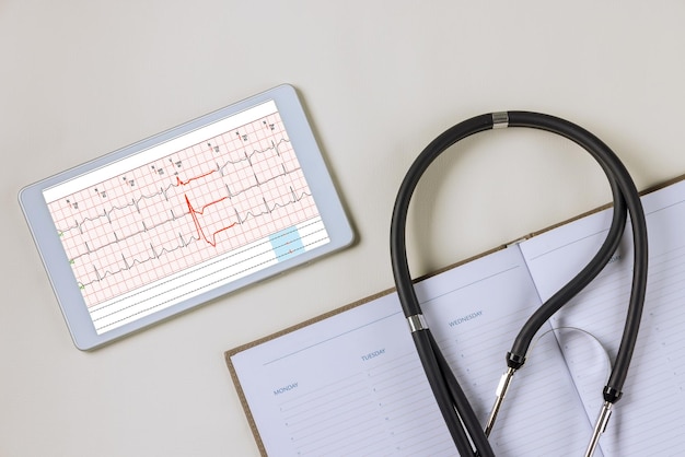 Lieu de travail du médecin avec un stéthoscope électrocardiogramme lectures de fréquence cardiaque sur table numérique