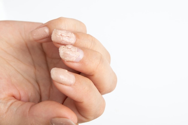 Liquide pour l'enlèvement à domicile du vernis à ongles en gel en action sur la main d'une femme