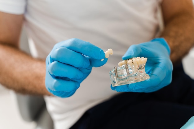 Mâchoire en plastique artificielle avec gros plan d'implants dentaires Prothèses dentaires et implants Consultation de prothèses dentaires avec un dentiste pour une patiente en dentisterie