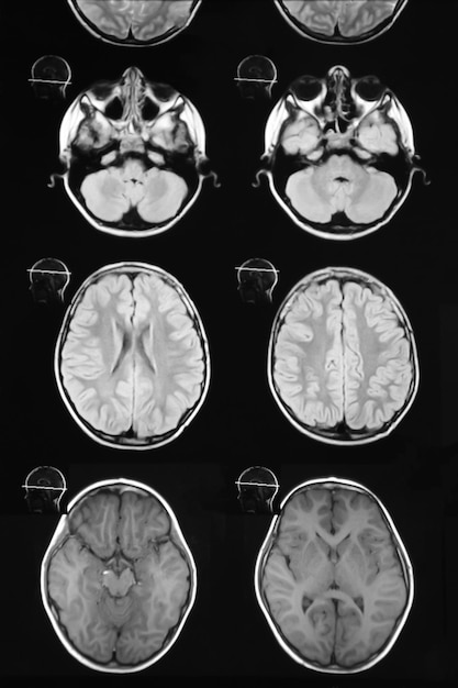 Macrophoto de tomographie par ordinateur avec le cerveau IRM médicale scientifique et éducative du cerveau