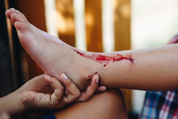 Photo une main coupée examinant une jambe saignante.