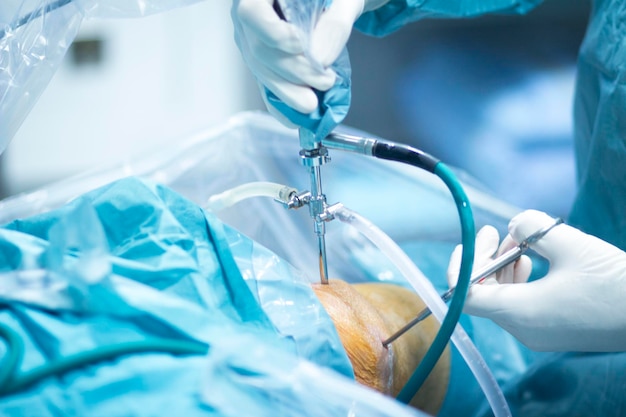 Main coupée d'un médecin opérant un patient lors d'une opération du genou