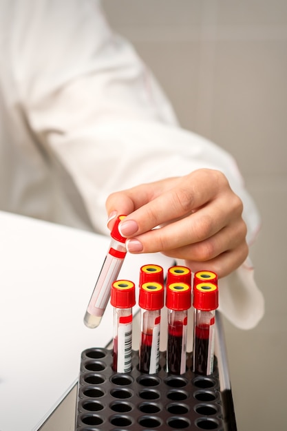 Photo la main du technicien de laboratoire ou de l'infirmière prend le tube à essai de sang vide du rack dans le laboratoire de recherche