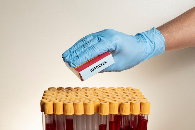 Main avec gant de protection en nitrile tenant la boîte de médicaments avec des tubes de prélèvement sanguin.