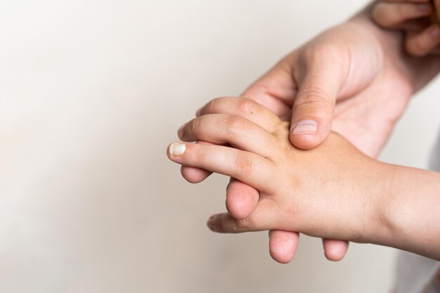 Photo une main de garçon avec un ongle écrasé