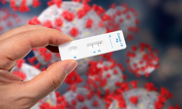 Une main masculine tenant un kit de test rapide d'antigène COVID19 avec deux lignes rouges indiquant positif