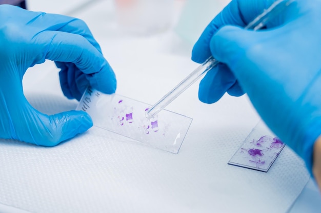 Photo mains dans un gant bleu tenant des lames d'histologie en verre