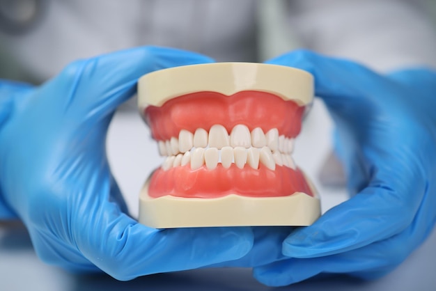 Mains de dentiste dans des gants stériles tenant un modèle artificiel de mâchoires spécialiste montre la structure