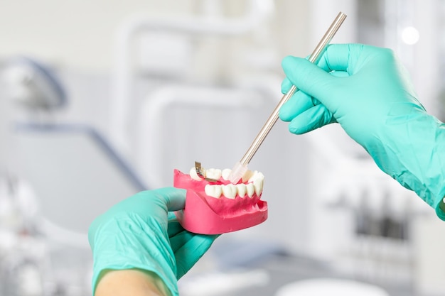 Les mains du dentiste dans des gants en latex avec l'éjecteur de salive et la disposition de la mâchoire humaine Bureau dentaire en arrière-plan Concept d'outils médicaux