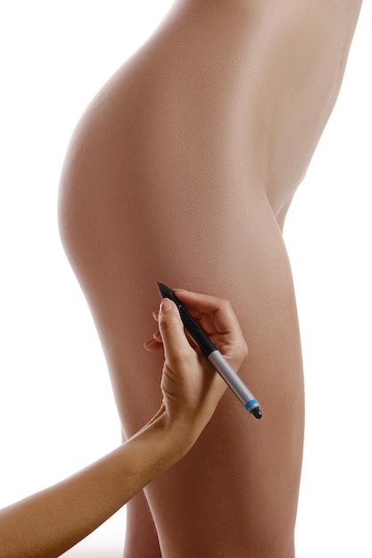 Les mains du médecin dessinent un schéma d'élimination de la cellulite avec un marqueur noir sur les fesses des femmes avant l'opération ...