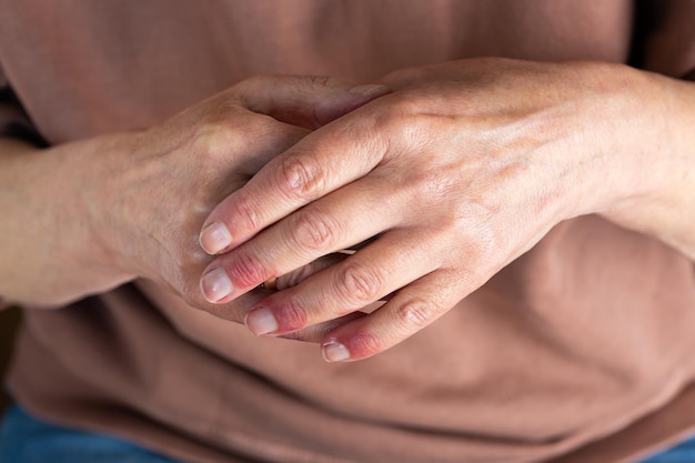 Mains de femme atteintes de dermatite atopique eczéma réaction allergique sur la peau