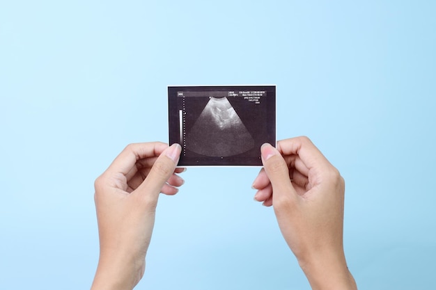 Photo des mains de femme tenant une image d'ultra-son de grossesse sur fond bleu