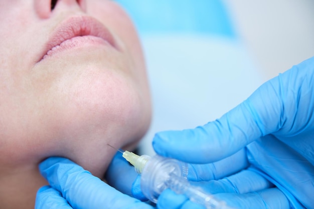 Mains avec des gants bleus injectant de la carboxythérapie à une fille dans le double menton