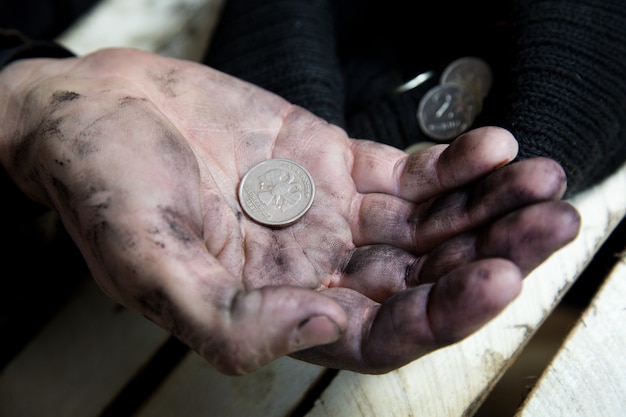 Les mains sales d'un vagabond.