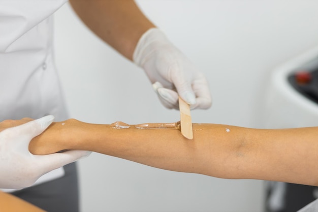 Le maître de l'épilation au laser applique un gel rafraîchissant sur la main de la femme avec une spatule