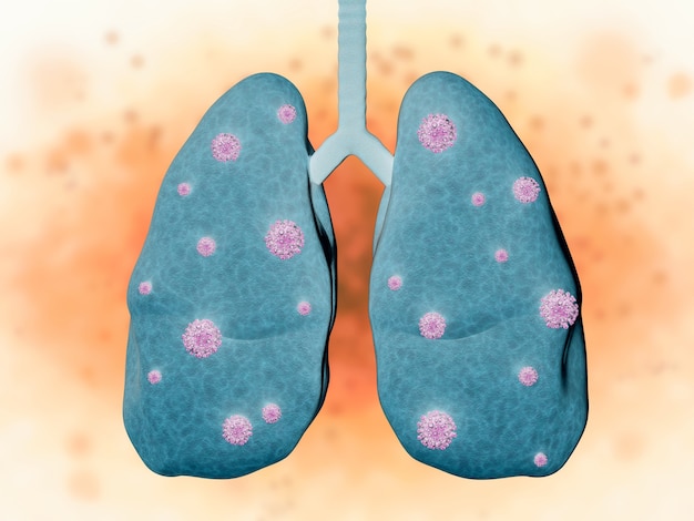 Maladie pulmonaire de rendu 3D avec des cellules bactériennes