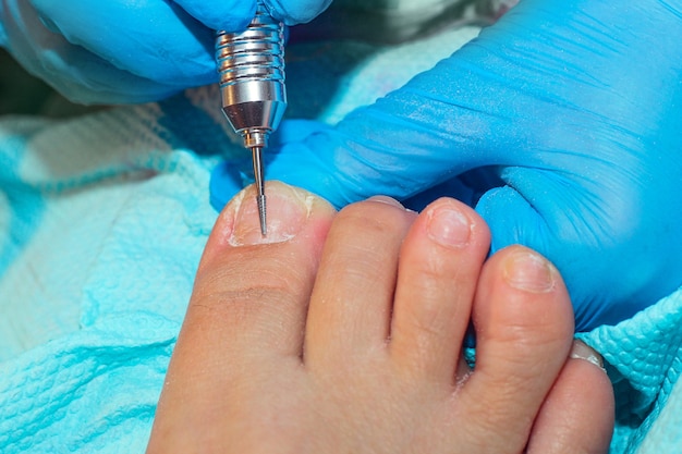 Un manipulateur ganté prépare la plaque à ongles de l'orteil pour le revêtement en gel.