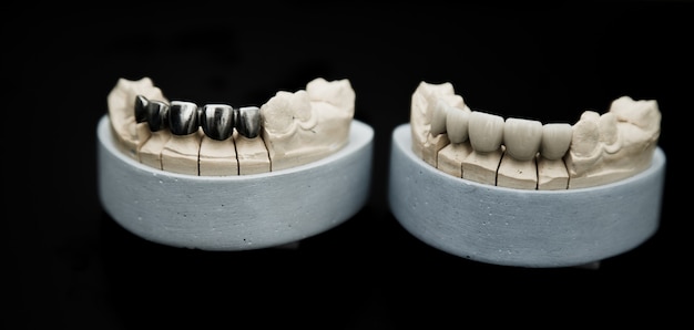 Maquette de mâchoire sur la table du dentiste