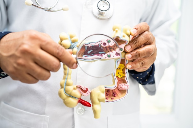 Médecin de l'appendice intestinal et du système digestif détenant un modèle d'anatomie pour le diagnostic et le traitement de l'étude à l'hôpital