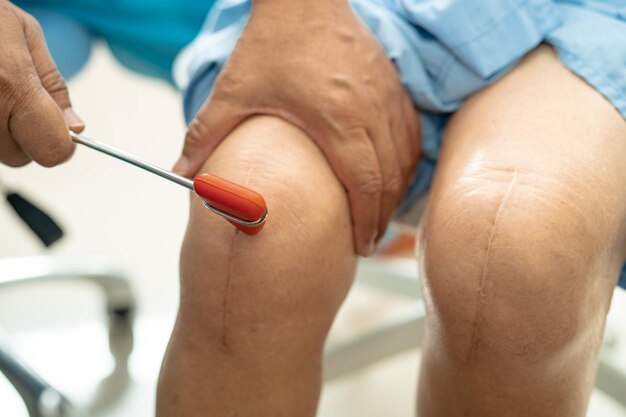 Un médecin asiatique utilise un marteau pour frapper une femme âgée pour vérifier le nerf réflexe du genou et le muscle à l'hôpital.