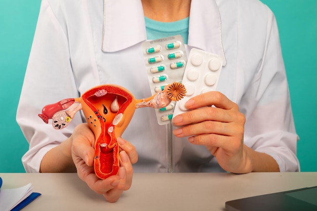 Le médecin détient le modèle d'organes reproducteurs féminins et de pilules en gros plan Concept de prévention du traitement de protection