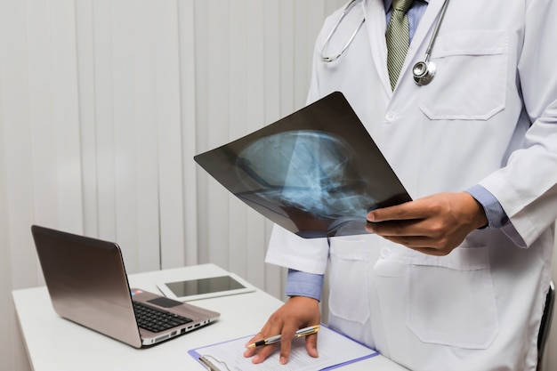 Un médecin diagnostique et analyse sur une radiographie du patient