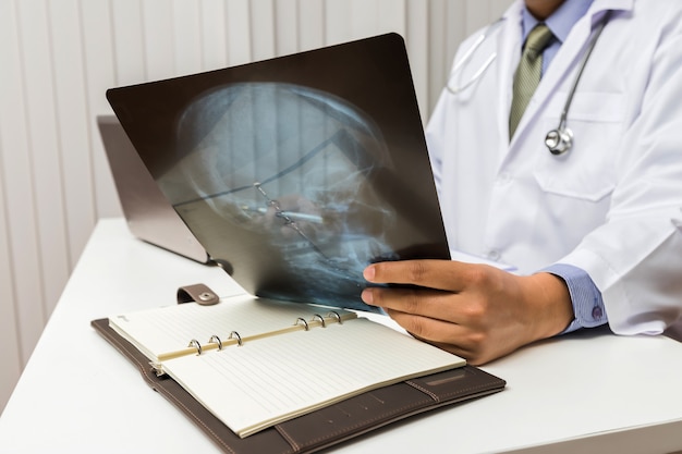 Le médecin diagnostique et analyse sur une radiographie du patient.