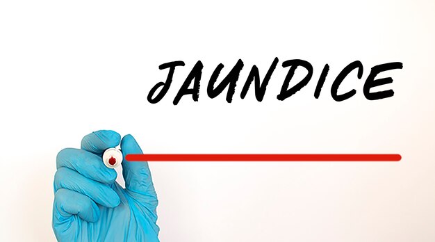 Médecin écrit du texte JAUNDICE avec marqueur rouge. Concept médical.