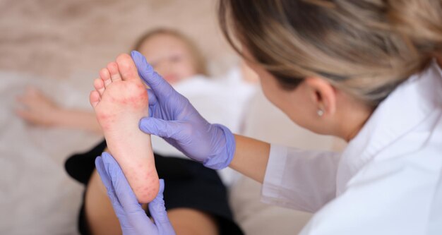 Photo le médecin effectue un examen médical de la jambe de l'enfant avec une éruption cutanée rouge qui démange de près