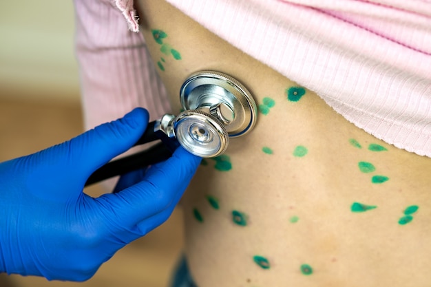 Médecin examinant un enfant avec un stéthoscope recouvert d'éruptions cutanées vertes sur le dos souffrant de varicelle, de rougeole ou de rubéole.
