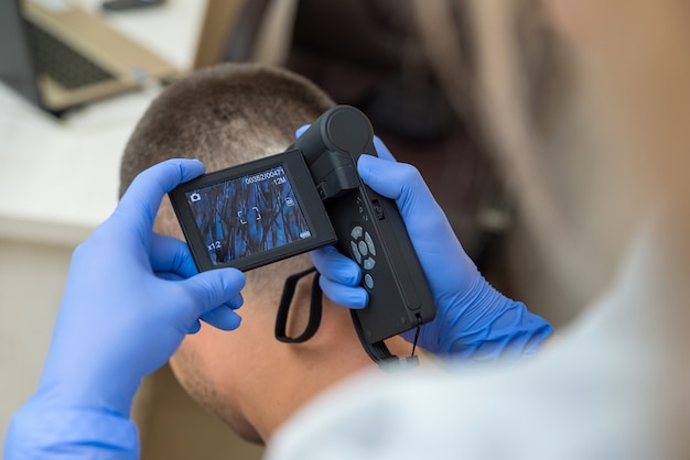 Le médecin examine le cuir chevelu du patient à l'aide d'un appareil optique