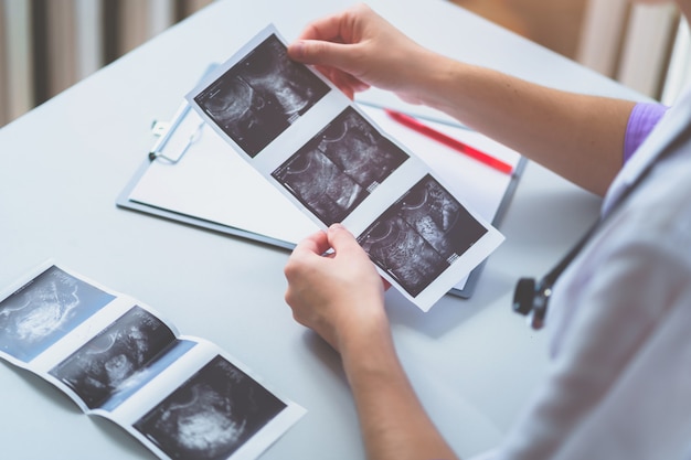 Un médecin examine les images échographiques d'un patient après l'échographie lors d'un bilan de santé et d'une consultation