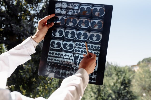 Médecin examine une radiographie sur un blanc