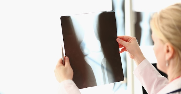 Le médecin examine une radiographie du genou du patient en clinique