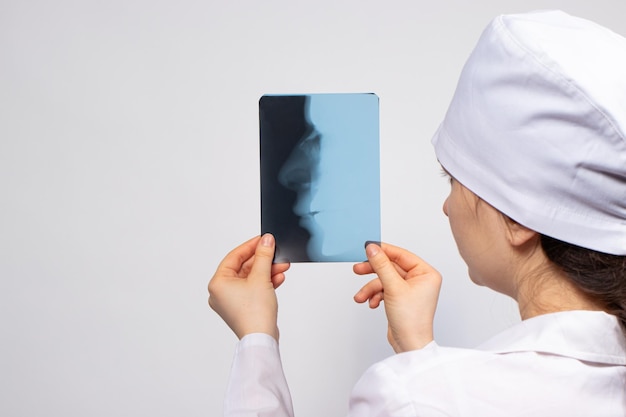 Un médecin examine une radiographie d'un patient avec un os du nez cassé.