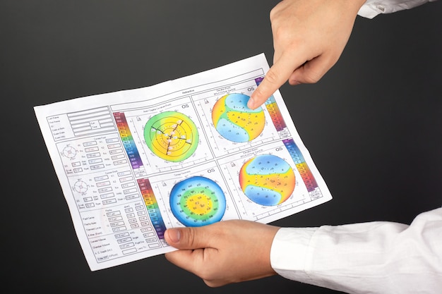 Le Médecin Examine La Topographie Cornéenne. Maladie Du Kératocône.